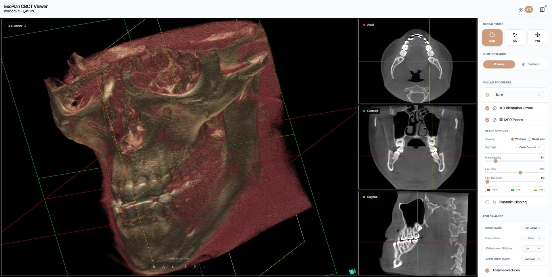 Vizualizator CBCT WafersDental